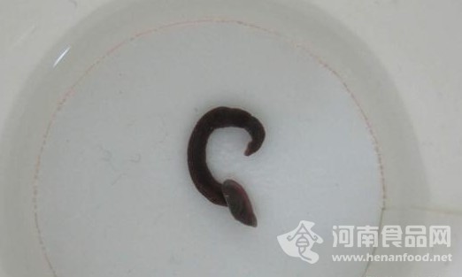 女孩支氣管中取出的螞蝗